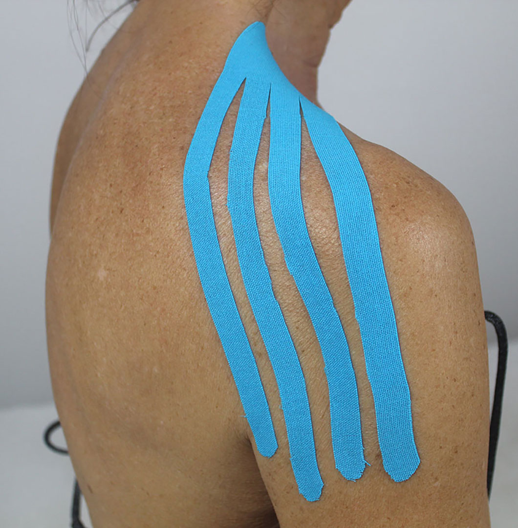 diploma-operatore-specializzato-tecniche-taping-kinesiologico-tutti-dettagli-diploma-riconosciuto-professionale diploma in operatore in tecniche di taping kinesiologico: tutti i dettagli di un diploma professionale e riconosciuto